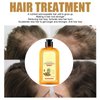 Ginaday Instant Ginger Hair Regrowth Shampoo, Ginger Anti-Fall Shampoo, Ginger Shampoo for Hair Growth, Ginger Hair Care Shampoo, Ginger Anti-Hair Loss Hair Shampoo (yellow 280ML)