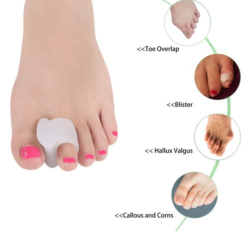 Misorita Gel Toe Spacers 12pcs to Restore Toes to Their Original Shape, Big Toe Separators Toe Spreaders Toe Straightener for Correct Bunion Overlapping Toes Hammer Toe Relaxation