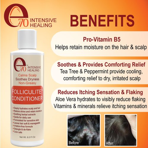 e70 Folliculitis Treatment Hair Conditioner | Moisturize Sensitive Skin, Itchy, Dry Scalp & Damaged Hair Repair | Herbal Extracts for Soft, Shiny Hair | Gentle Color-Safe Detangling Solution