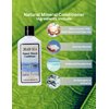 Malki Dead Sea Products Natural Mineral Conditioner | Dead Sea Conditioner for Itchy Scalp | Eczema and Psoriasis Support, Paraben Free, Softening, Detangling, and Hydrating, Itchy Scalp Conditioner