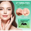 LivaClean (102 Strips Charcoal Blackhead Remover Pore Strips for Face Nose Pores - Blackheads Removal - Blackhead Removers - Blackhead Remover Strip - Black Head Nose Strips Black Head Remover