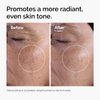 The Ordinary Glycolic Acid 7% Exfoliating Toner, Brightening and Smoothing Daily Toner for More Even-Looking Skin Tone, 8.1 Fl Oz