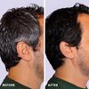 Colorsmith Hair & Beard Color for Full Gray Coverage 2 pack - Dark Ash Brown - Ammonia-Free Complete Men’s At-home Beard & Hair Dye Kit, Professional-grade Permanent Hair Color (4.1)