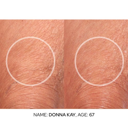 SiO Cryo Multivitamin Face & Body Scrub - Antioxidant-Rich Exfoliator