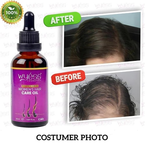 WYESS Hair Oil, Natural Hair Growth Oil, Argan Oil for Hair Growth, Stimulating Hair Oils for Hair Growth For Women, Easy to Use Hair Serum (1.69 Fl Oz) - For Women (Hair Oil)