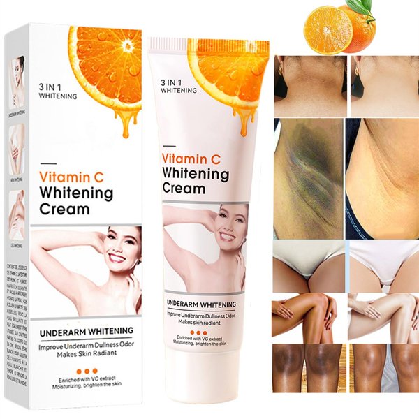 Vitamin C Skin Whitening Cream,Skin Bleaching Cream,Dark Spot Remover for Face,Skin Lightening Cream for Intimate Areas,Neck,Armpit,Elbow, Inner Thigh and Knees,Improve Underarm Dullness Odor