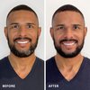 Colorsmith Hair & Beard Color for Full Gray Coverage 2 pack - Dark Ash Brown - Ammonia-Free Complete Men’s At-home Beard & Hair Dye Kit, Professional-grade Permanent Hair Color (4.1)