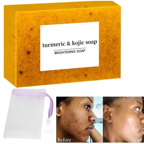 Nicgou Lemon Turmeric Kojic Soap, Turmeric Soap Bar for Face ＆ Body，Natural Turmeric Handmade Soap for All Skin Types