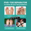 Welnove Toe Separator Bunion Corrector- 8 Pack Toe Straightener for Women Men Overlapping Toes - Toe Spacers for Nighttime, Running & Yoga Practice（Black/Blue*8）