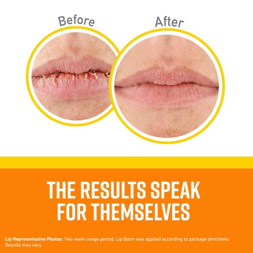 O'Keeffe's Lip Repair SPF 35 Lip Balm - Stick (3 Pack) - Sun-Safe Moisturizer for Extremely Cracked, Dry Lips