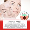 Wentoenapp 240 Pcs Star Pimple Patches,Pimple Patches for Face,Spot Stickers for Face and Skin Treatments and Masks, Pore Cleansing Strips