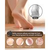 Pumice Stone Foot File, 4pcs Set Callus Remover for Feet with Wooden Handle, Pedicure Foot Scrubber to Remove Dead Skin, Dry, Rough, Corns Skin Scraper