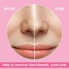 JOLVKA Blackhead Remover Pore Strips for Nose - 65 Strips - Charcoal Blackheads Removal - Blackhead Strip - Pore Cleaner