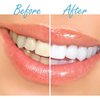 DentaPro Activated Bamboo Charcoal Teeth-Whitening Toothpaste With Mint Flavor