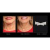 NeckTITE Magic - The Instant Neck Lift