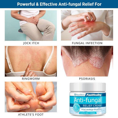 Roycederm Antifungal Cream, Athletes Foot Treatment Cream, Jock Itch Cream, Antifungal Treatment for Athletes Foot, Eczema, Psoriasis, Jock Itch, Anti Itch, Rash, Ringworm Treatment for Humans