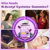 Sijigood 1000mg NAC Gummies for Kids & Adults - NAC Supplement N Acetyl Cysteine Dietary Gummies Support Respiratory & Liver Health, Antioxidants & Immune System, Blueberry Flavor 60 Count