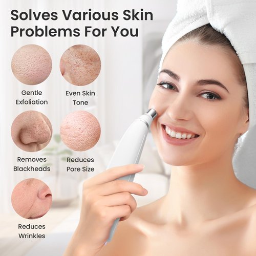 UNOISETION Diamond Microdermabrasion Machine, Portable Dermabrasion Facial Machine for Exfoliation, Blackhead Remover Pore Vacuum for Home Use