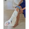 Blue Jay An Elite Healthcare Brand Cast Cover [Short Leg] - Waterproof Bandage Protector | Watertight Seal, Reusable, Easy to Use | Medical Supplies & Equipment