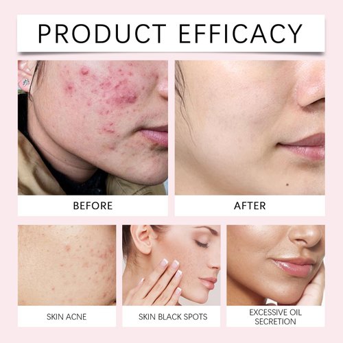 Turmeric Kojic Acid Cleansing Pads, for Face Deep Cleansing Scrub Exfoliating. (40 Pcs)