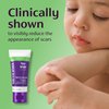 Mederma Scar Gel for Kids; Reduces the Appearance of Old and New Scars from Cuts, Burns, Surgery; Goes on Purple and Rubs in Clear; Grape Scented; Ages 2+, 0.70 Oz