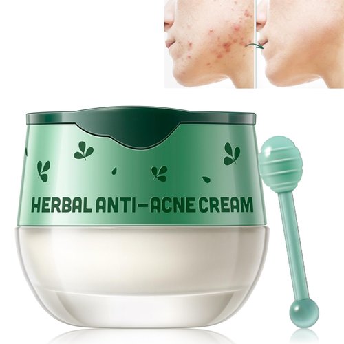 Herbal Acne Cream for Oily, Acne Prone Skin, Crema Para Acne En La Cara Reduce Redness, Day & Night Moisturizer Face Cream for Women & Men