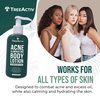 TreeActiv Acne Eliminating Body Lotion, 8 fl oz, Salicylic Acid Lotion, Salicylic Acid Body Acne Treatment, Back Acne Treatment Cream for Women and Men, Acne Lotion for Body, Zit Cream with 2000+ Uses