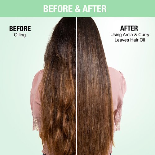 Nykaa Naturals Hair Oil, Amla and Curry, 6.76 oz - Hair Growth Oil for Hair Loss and Thinning - Reduce Breakage and Hair Fall - Safe for Colored Hair