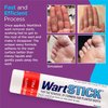 WartStick Wart Remover 0.2 oz (Pack of 4)