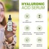 Herbalicious Hyaluronic Acid Serum – Hyaluronic Acid Serum for Face – Paraben-Free Pure Hyaluronic Acid – Moisture Boost Hydrating Serum – Anti-Aging Serum for Fine Lines, Wrinkles – 2oz