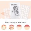 48 Pcs Clear Lady Pimple Constructed of Pectin Patch Safe Fast Absorption Compact Quick Invisible Acne Patch for Women Pimple Patch Cover Acne 0.8-1.2cm Treatments and Masks