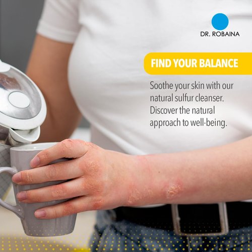 Dr. Robaina Sulfur Soap for Acne & Eczema Relief, Antioxidant, Dermatitis & Sensitive Skin Care (Pack of 2)