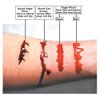 Graftobian Blood Sampler Set Makeup Kit - with 4 FX Bloods - Blood Gel, Blood Paste, Stage Blood, Magic Blood Powder