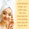 10% Sulfur Soap Cleansing Bar for Face & Body – All Natural Sulfur Facial Cleanser for Acne, Oily Skin – Skincare Blend of Lemongrass, Tea Tree Essential Oil, Vitamin E, Coconut Milk – Sulfur Soap Bar Made in USA (4 Ounce (Pack of 1))