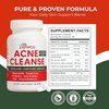 Acne Cleanse Capsules.Powerful Vitex Angus Extract, Niacinamide, Biotin for Teens & Adults. Organic Acne Treatment,Cystic Pimples, Oily Skin to Natural Clear Skin Vitamins Supplement- 60 Count