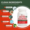 Acne Cleanse Capsules.Powerful Vitex Angus Extract, Niacinamide, Biotin for Teens & Adults. Organic Acne Treatment,Cystic Pimples, Oily Skin to Natural Clear Skin Vitamins Supplement- 60 Count