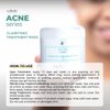 Celesty Beauty Clarifying Acne Treatment Pads Salicylic, Lactic - Acids Antioxidant Boosting Skin Hydration Pads
