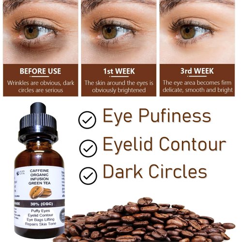 Puffy Eyes Caffeine Herbal Infusion 30% & Green Tea Skin Serum Eyelid Contour Natural Ingredients