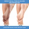 ForPro Professional Collection Advanced Callus Eliminator Gel, Professional Grade, No Drip Callus Remover Gel for Feet, 8 oz.