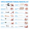 Ingrown Toenail Removal Tool Kit: 113pcs Ingrown Toe Nails Clipper for Thick Curved Nail Remover Set Straightener Corrector Patch and Strips