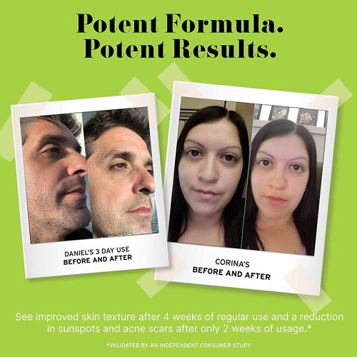 No B.S. (No Bad Stuff) Caffeine Eye Cream with Pure Hyaluronic Acid & Plant Based Squalane Oil, Under Eye Cream for Dark Circles & Puffiness, Skin Care for Women & Men, Vegan, Travel Size, 0.5 FL Oz