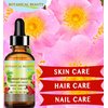 Botanical Beauty ROSEHIP SEED OIL Pure For Face, Skin, Hair and Body. Anti-Aging Moisturizer Facial Oil 0.5 Fl oz 15 ml