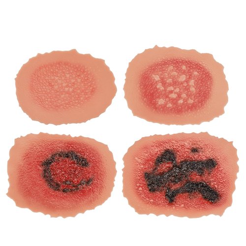 MedEduQuest Burn Wound Packing Trainer, Burn Moulages Kit, Adhesive Skin Burn Wound Trainer for Wound Care Training, Burn Wound Training Model