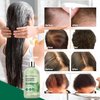 Svvimer Hair Thickening Shampoo and Conditioner - Rosemary Shampoo with Biotin Tea Tree Oil Mint for Hair Loss and Thinning Hair - Sulfate Free for Women and Men