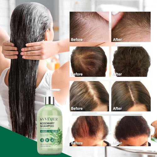 Svvimer Hair Thickening Shampoo and Conditioner - Rosemary Shampoo with Biotin Tea Tree Oil Mint for Hair Loss and Thinning Hair - Sulfate Free for Women and Men