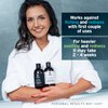 Sphagnum Botanicals Psoriasis Shampoo - Peat Mud & Fulvic Acid Therapy for Itchy and Red Scalp Treatment. No Coal Tar. 8.45 Oz