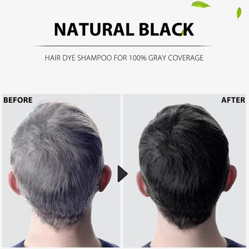 Instant Black Hair Shampoo, 3 in 1 Natural Black Hair Dye Shampoo with Herbs, Cover Greys Hair for Men & Women, Permanent Black Hair Color - Ammonia Free, Herbal Black Hair Dye 400ml (Black)