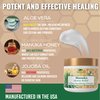 Manuka Honey Cream - Eczema Honey Cream - Moisturizer Lotion Treatment for Ezcema & Psoriasis - Ultra Soothing Relief - Face & Body Care Itchy Dry Skin Rash Healing Ointment - For Adults & Kids (4oz)
