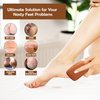 Love Natural Pumice Stone for Feet - 2-Sided Terra Cotta Foot Scrubber, Professional Exfoliating Clay Stone for Feet Hands Body Care - Pumice Stone for Feet Callus Remover & Dead Skin