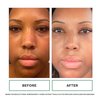 Replenix Anti-Aging Tinted Brightening Eye Cream with Medical Grade Hyaluronic Acid (8.5 ml)